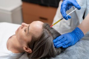 microneedling treatment In NYC 
