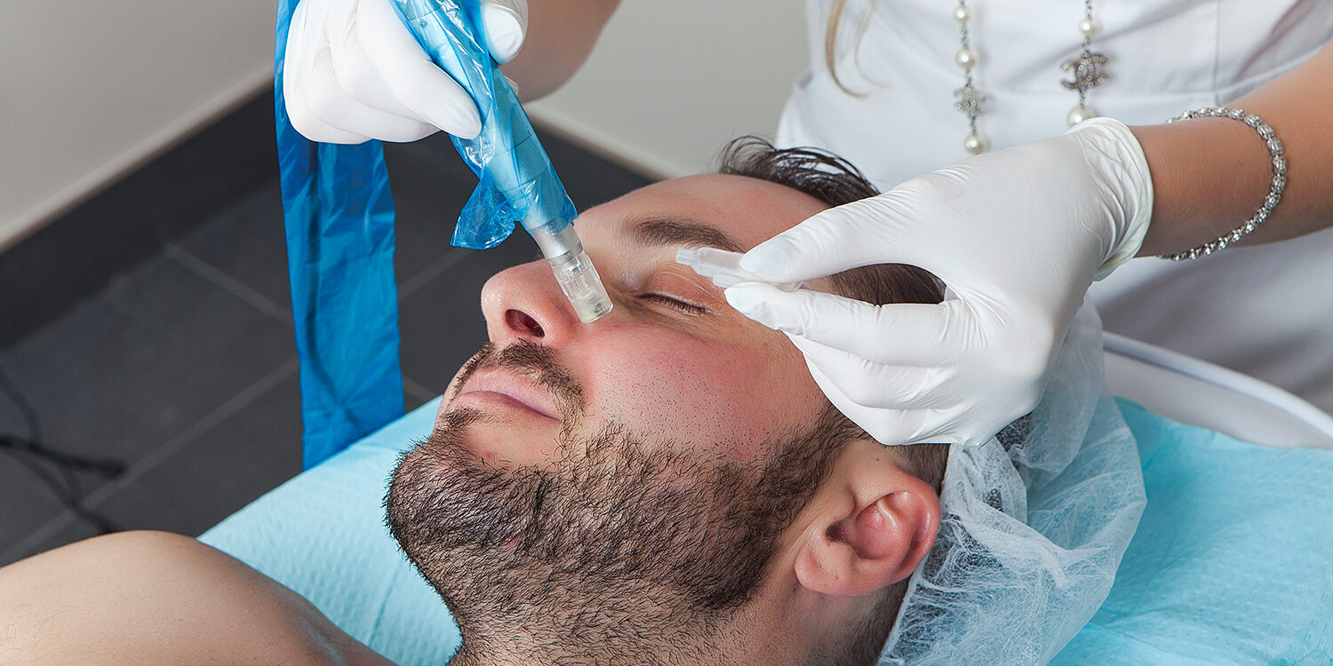 Microneedling Nyc Microneedling Nyc