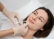 PRP Microneedling NYC