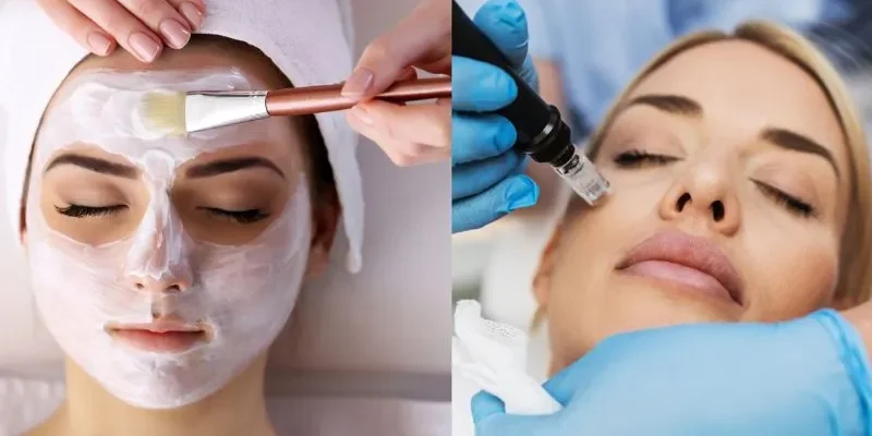 Microneedling vs. Chemical Peels Microneedling vs. Chemical Peels