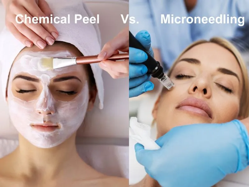 Microneedling vs. Chemical Peels