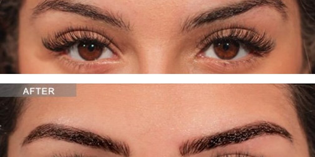Microblading Healing Process Day-by-Day