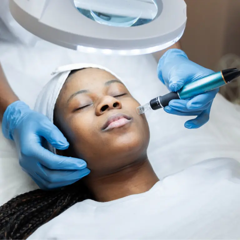 How Many Microneedling Sessions Do You Need? | Expert Guide
