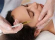 How Many Microneedling Sessions for Best Results? Expert Guide
