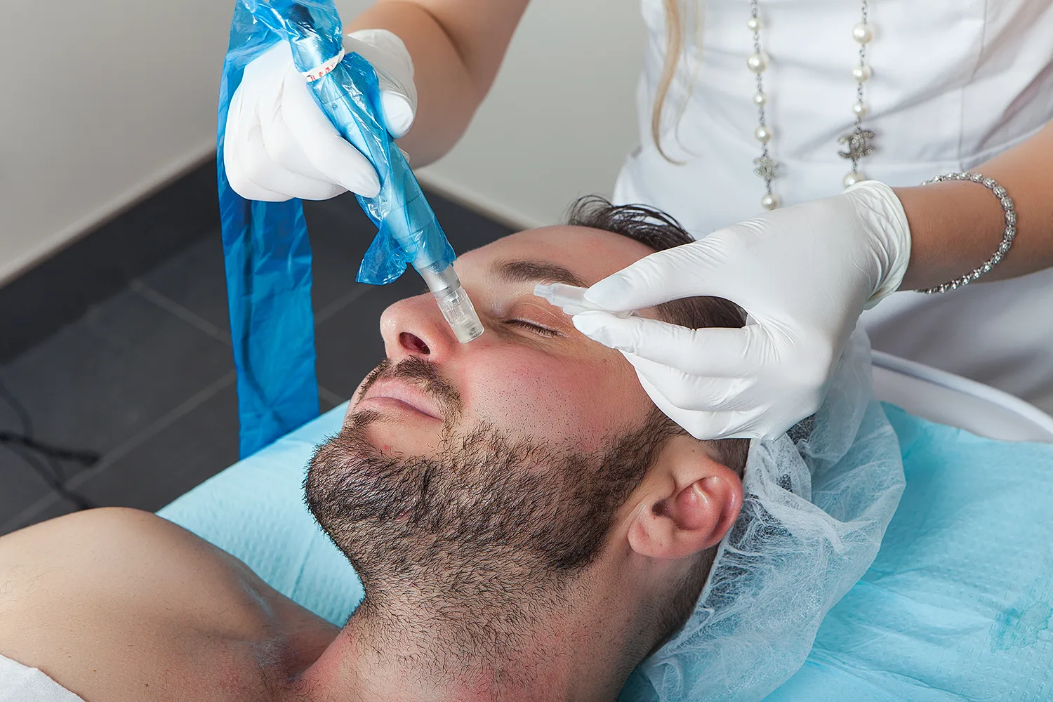 Microneedling facial treatment for collagen stimulation at Karmina Beauty Clinic