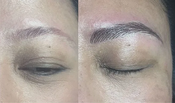 Before and after Best Microblading in NYC